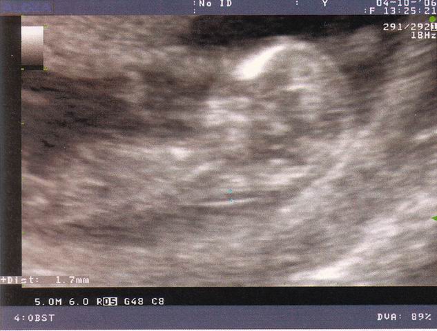 2006.10.04 echo5.jpg